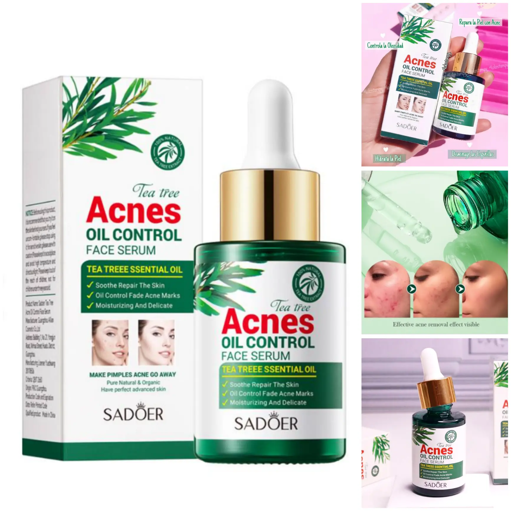 Sérum de Té Verde Antiacne Sadoer - Controla el brillo y combate el acné suavemente. Regula la grasa, reduce inflamación y calma el enrojecimiento con extracto de té verde (antioxidante y antibacteriano). Ideal para piel grasa/mixta o sensible con brotes. 30ml