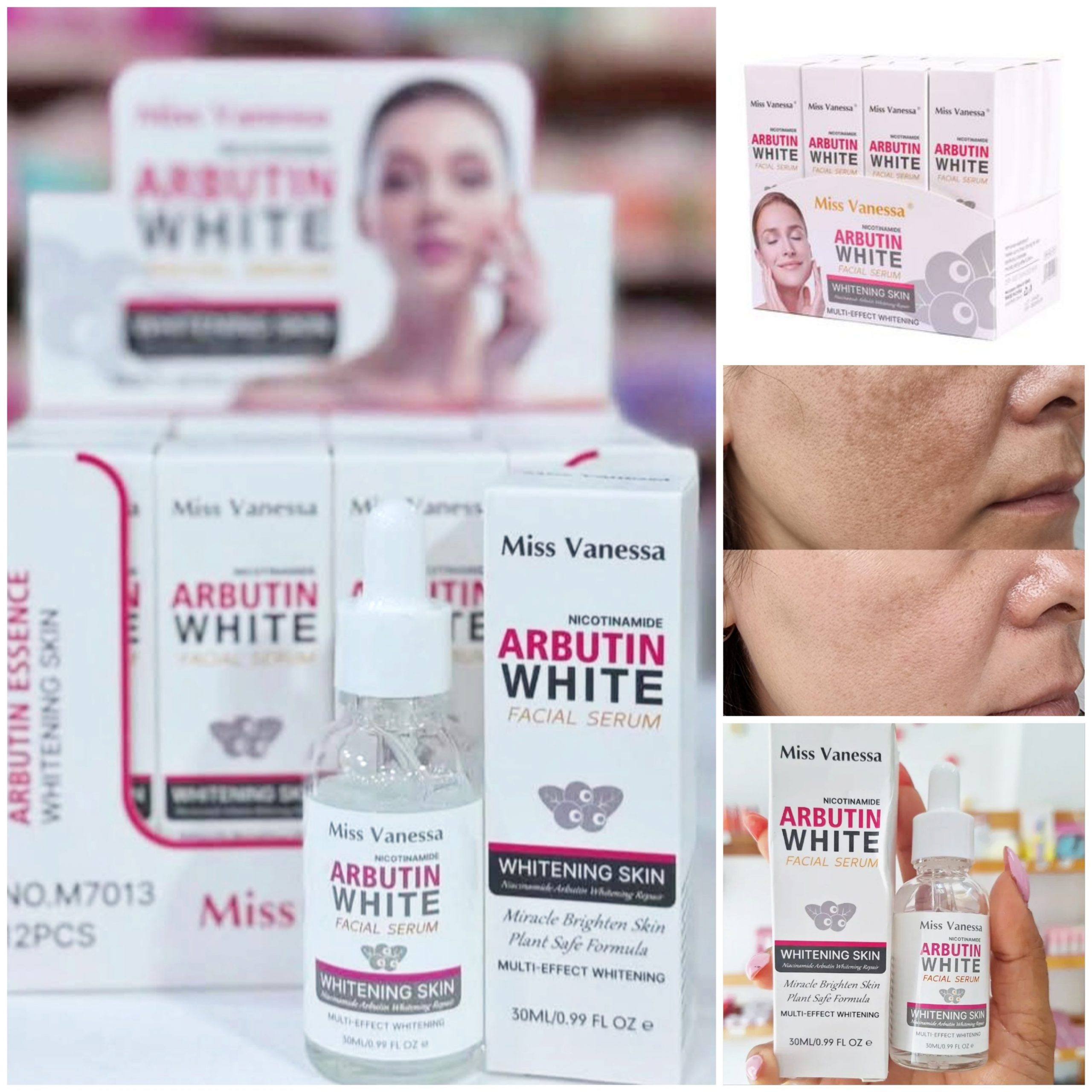 Sérum Iluminador Niacinamida + Arbutina: ¡Piel uniforme, hidratada y radiante! Combate manchas, minimiza poros y refuerza la barrera cutánea. Con ácido hialurónico para hidratación profunda y alantoína para calmar. Ideal para hiperpigmentación y tono desigual. 30ml | ¡Uso diurno/nocturno sin irritación!