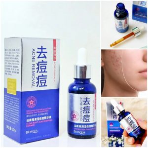 Sérum Removedor de Acné: ¡Tratamiento multiactivo para pieles acneicas! Combina Forsythia suspensa (antibacteriano), Leonurus artemisia (regulador de sebo) y propóleo (cicatrizante) para eliminar brotes, reducir rojeces y prevenir nuevas imperfecciones. Hidratación equilibrada con glicerina. Ideal para acné leve/moderado. 30ml