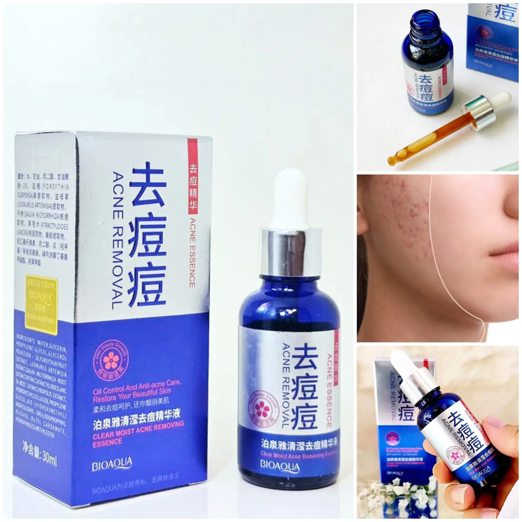 Sérum Removedor de Acné: ¡Tratamiento multiactivo para pieles acneicas! Combina Forsythia suspensa (antibacteriano), Leonurus artemisia (regulador de sebo) y propóleo (cicatrizante) para eliminar brotes, reducir rojeces y prevenir nuevas imperfecciones. Hidratación equilibrada con glicerina. Ideal para acné leve/moderado. 30ml