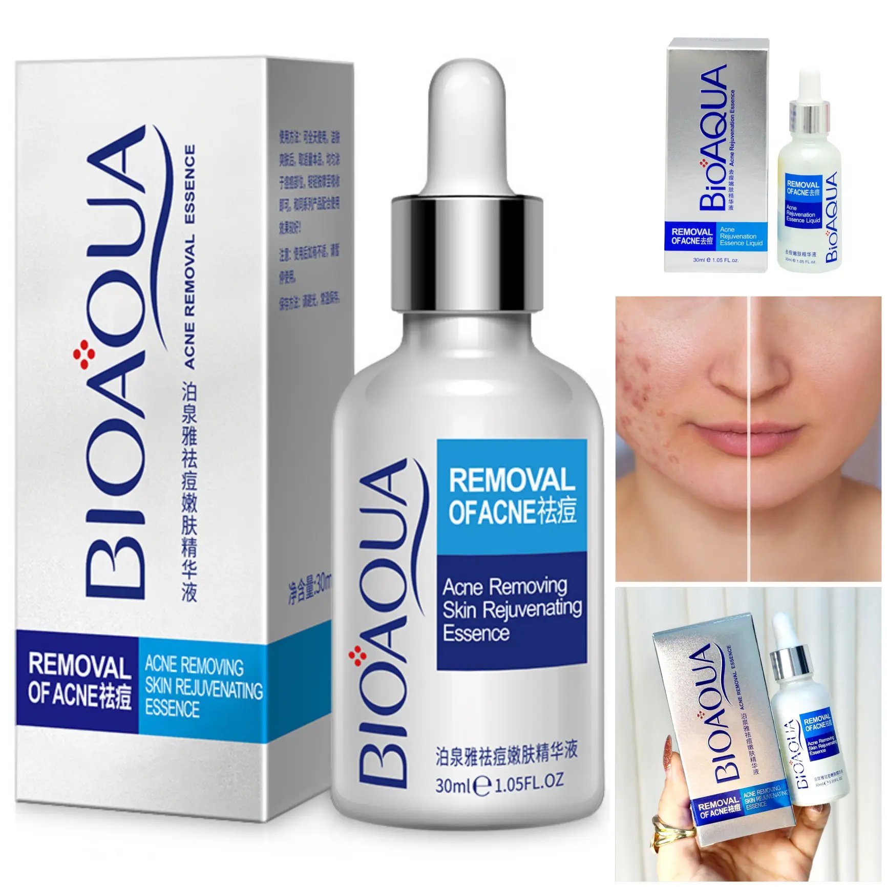 Sérum Anti-Acné Hidratante: ¡Adiós a los brotes sin resecar la piel! Formulado con Aloe Vera (calmante), Ácido Hialurónico (hidratación) y Hidroxiacetofenona (antioxidante purificante). Reduce inflamación, previene nuevas imperfecciones y mantiene la barrera cutánea sana. Ideal para pieles grasas/mixtas con tendencia acneica. 30ml | ¡Uso diario sin irritación!